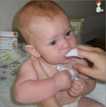 لماذا عند الرضع اللسان الأبيض تحديد سبب والحصول على العلاج