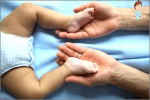 Dysplasia Hip-Gelenk in Neugeborenen