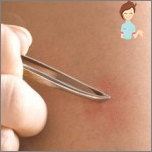 Treatment and removal of ingrown hair