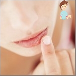 Tipps zur Behandlung und Prävention der verwitterten und gebrochenen Lippen