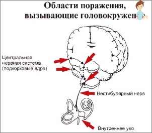 Hlava se točí s onemocněním mozku a hlavy hlavy