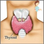 Thyroiditis