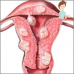 Myoma-Gebärmutter und Schwangerschaft