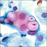 What is dangerous chlamydia for men and women