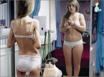 Anorexia