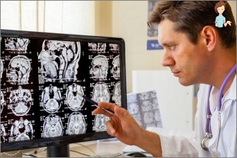 Intracranial pressure: symptoms and signs