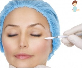 Blepharoplasty