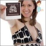 Ist es möglich, mit Eierstock polycystisch schwanger zu werden