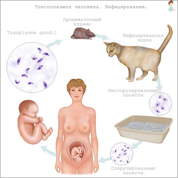 Toxoplazmóza a těhotenství - zdroje infekce, symptomy, léčba