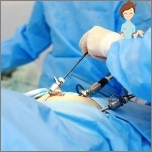 Laparoskopie - was Sie über das Verfahren wissen müssen?
