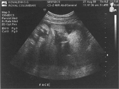 Schwangerschaft 42 Wochen - Entwicklung des Fötus und der Empfindung der Mutter