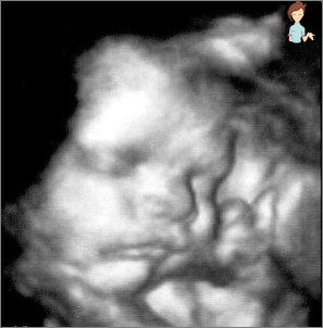 الحمل 38 أسبوع - تطوير الجنين والإحساس بالأم