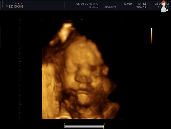 الحمل 37 أسبوعا - تطوير الجنين والإحساس بالأم