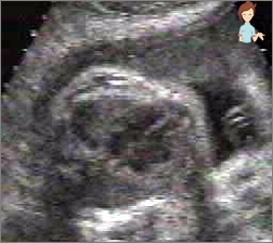 الحمل 36 أسبوعا - تطوير الجنين والشعور