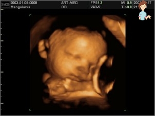الحمل 33 أسبوع - تطوير الجنين والإحساس بالأم