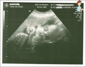 الحمل 31 أسبوعا - تطوير الجنين والشعور بالأم