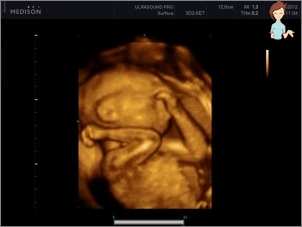 Ultraschall 27 Wochen Schwangerschaft