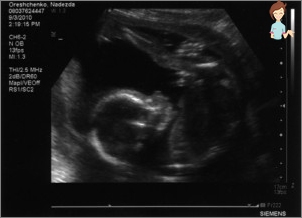 Schwangerschaft 28 Woche - Entwicklung des Fötus und des Gefühls einer Frau