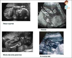 Uzi -22 săptămâna de sarcină