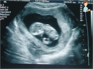 Ultraschall für 12 Wochen Schwangerschaft