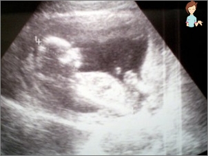 Ultraschall für einen Zeitraum von 10 Wochen Schwangerschaft