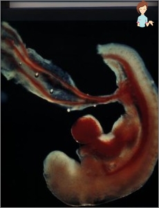 Foto des Embryos um 4 Schwangerschaftswoche