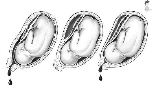 La capacidad de quedar embarazada a través de la menstruación