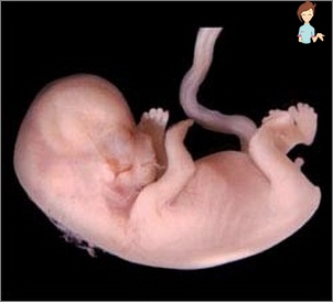 Плод 11 недель фото. Плод на 11 неделе беременности. Фото плода 11 недель беременности фото. Эмбрион на 11 неделе беременности. Плод нв 11 недель беременности.